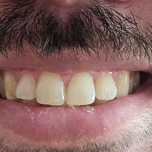 Meet your Posher, Benjamin - Picture 1 of 1